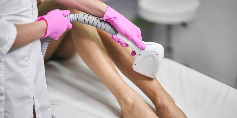 як працює лазерна епіляція